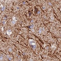 HPA IHC Cerebral cortex — NEDD4