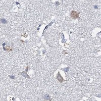 HPA IHC Cerebral cortex — MRPL51