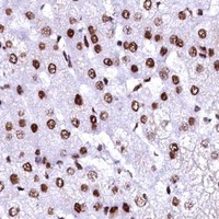HPA IHC Liver — CPSF6