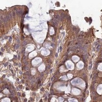 HPA IHC Colon — LAYN