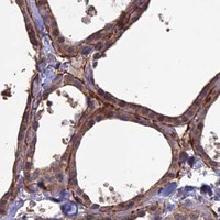 HPA IHC Thyroid gland — LAYN