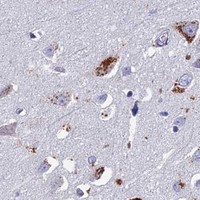 HPA IHC Cerebral cortex — OAT