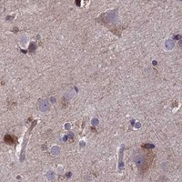 HPA IHC Cerebral cortex — MAST2