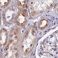 HPA IHC Kidney — TMEM18