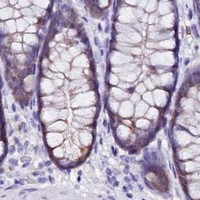 HPA IHC Colon — SORD