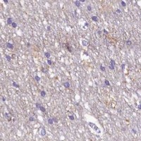 HPA IHC Cerebral cortex — SORD