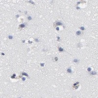 HPA IHC Cerebral cortex — NFKB1