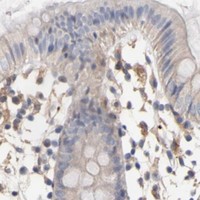 HPA IHC Colon — ILK