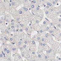 HPA IHC Liver — ILK