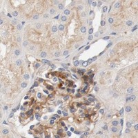 HPA IHC Kidney — ILK