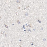 HPA IHC Cerebral cortex — ILK