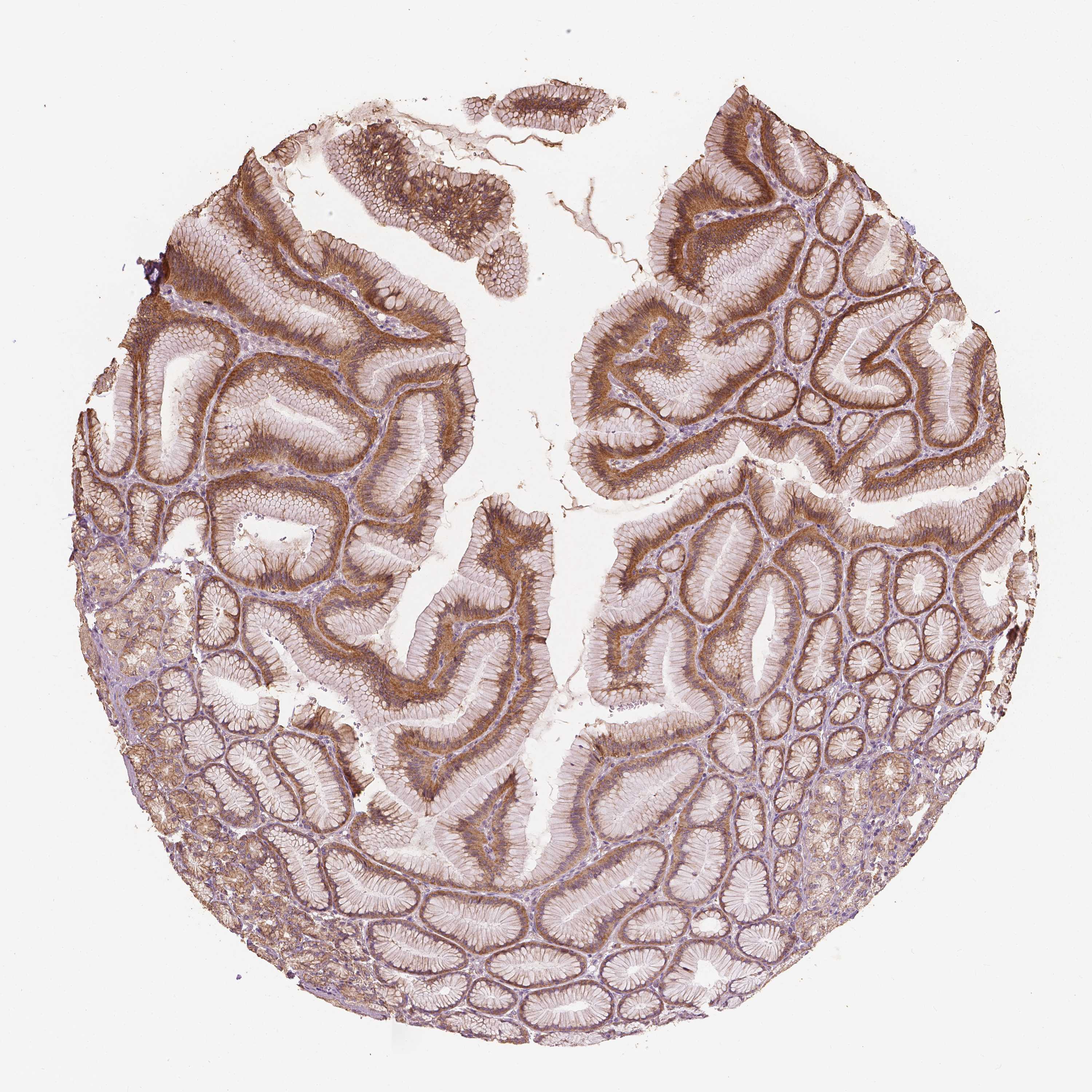 Tissue expression of G3BP1 Staining in stomach The Human Protein Atlas