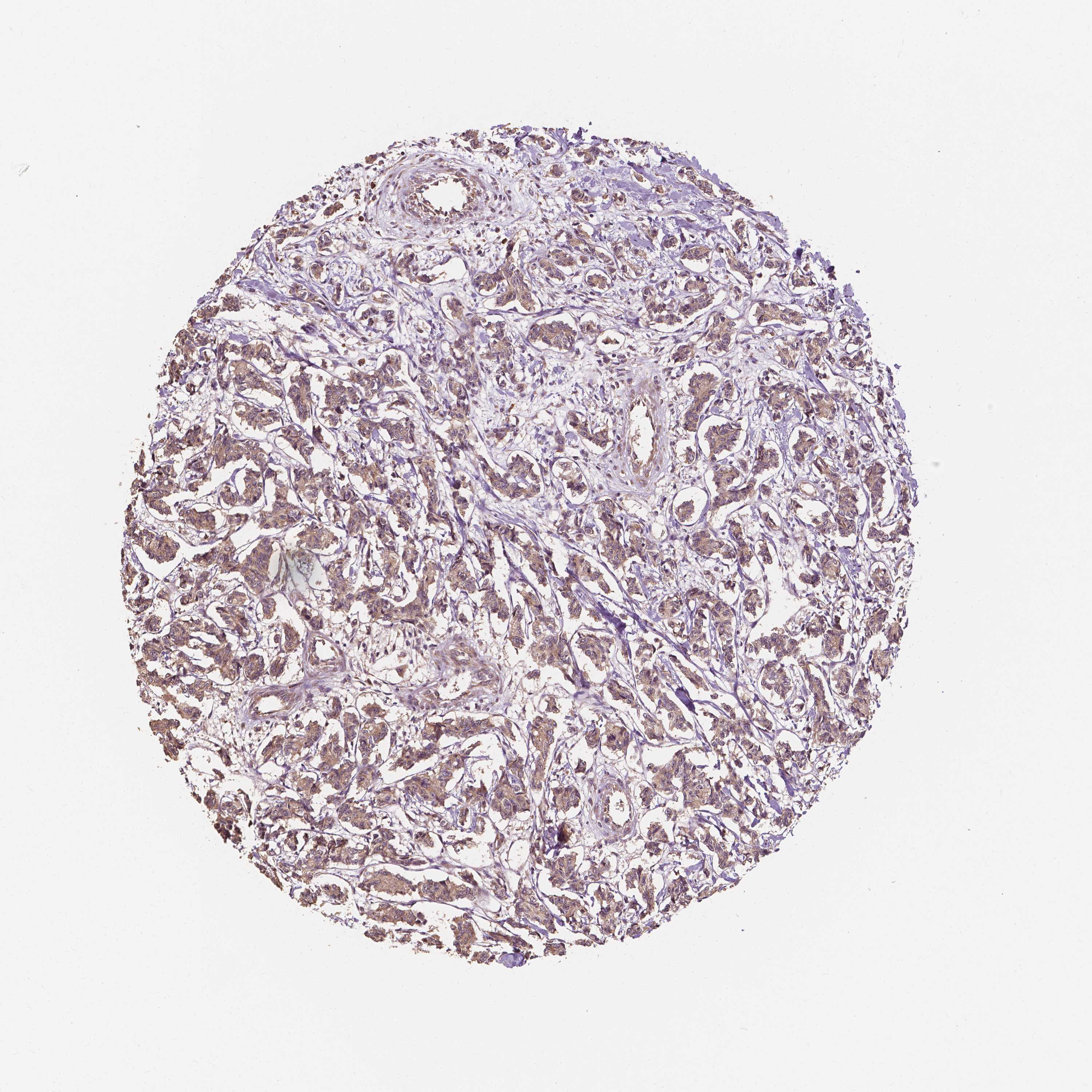 Expression of G3BP1 in carcinoid The Human Protein Atlas