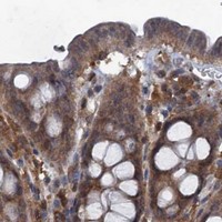 HPA IHC Colon — GCLM