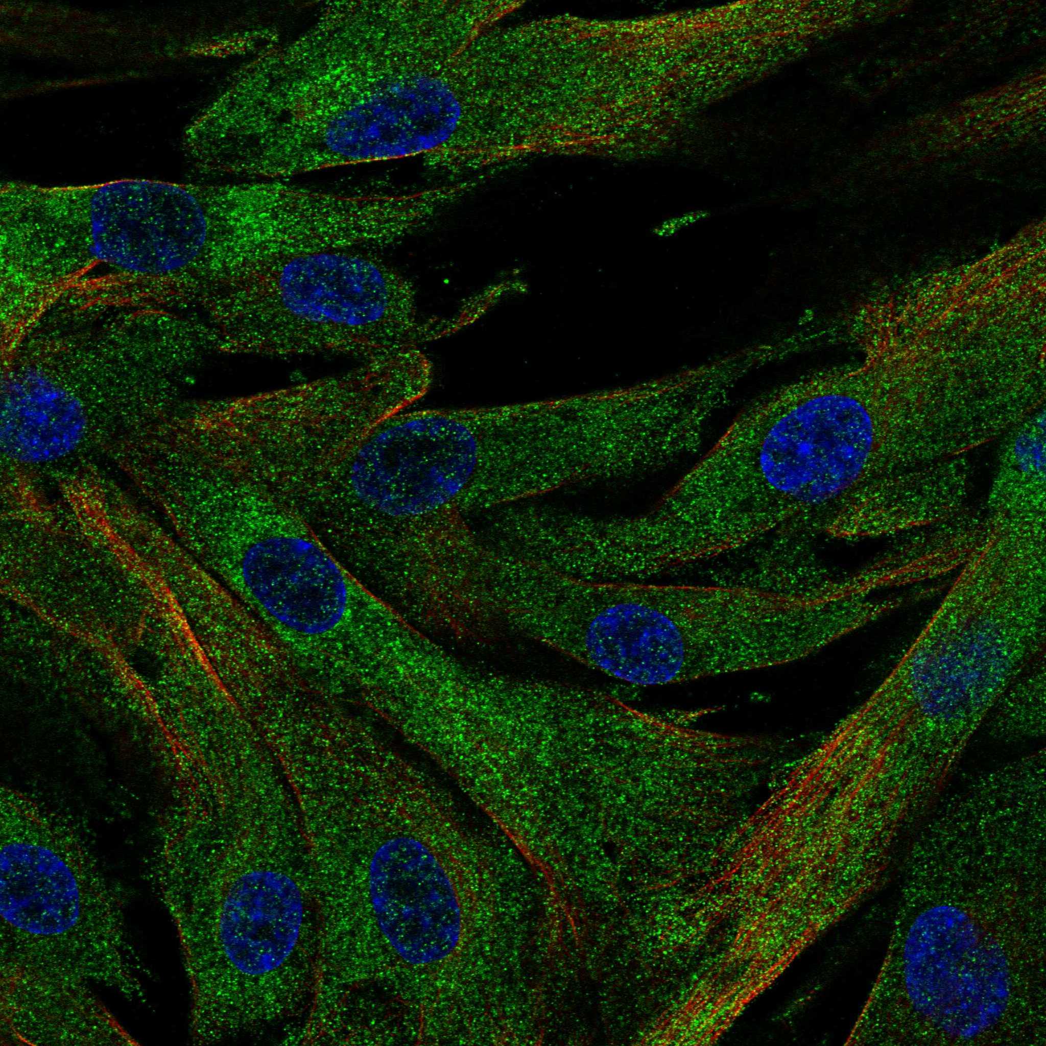 Subcellular SCUBE3 The Human Protein Atlas