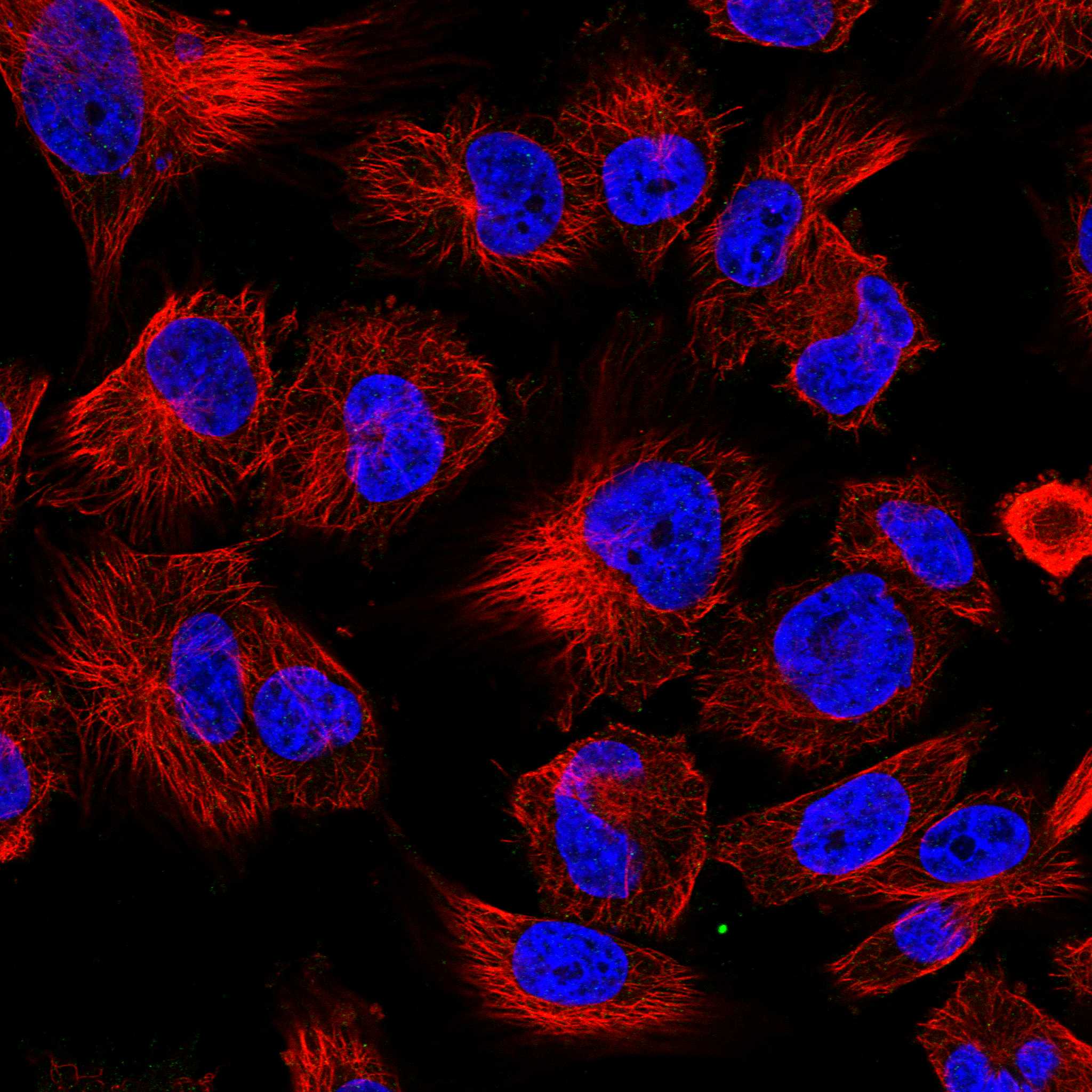 Subcellular SCUBE3 The Human Protein Atlas