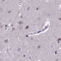 HPA IHC Cerebral cortex — NIPBL