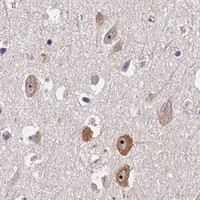 HPA IHC Cerebral cortex — EIF6