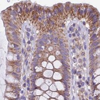 HPA IHC Colon — MGME1