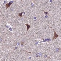 HPA IHC Cerebral cortex — MGME1