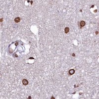 HPA IHC Cerebral cortex — HAND1