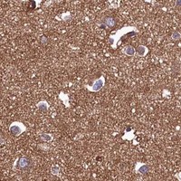 HPA IHC Cerebral cortex — UBE3B