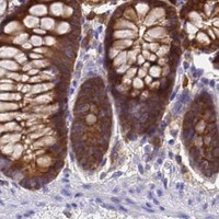 HPA IHC Colon — NME2