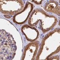 HPA IHC Kidney — NME2
