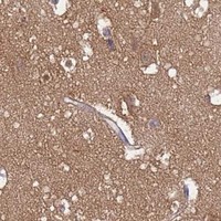 HPA IHC Cerebral cortex — NME2