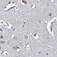 HPA IHC Cerebral cortex — ADCY9
