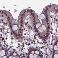 HPA IHC Colon — RNF40