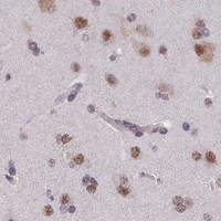 HPA IHC Cerebral cortex — RNF40