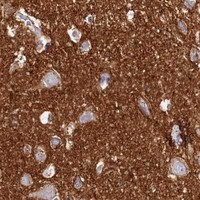 HPA IHC Cerebral cortex — FXYD6