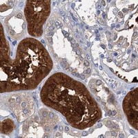 HPA IHC Kidney — FAH