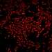 HPA041411: U-2 OS, siRNA 1 (10x)