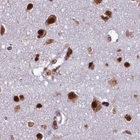 HPA IHC Cerebral cortex — SNRPD2