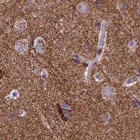 HPA IHC Cerebral cortex — IDH3A