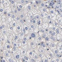 HPA IHC Liver — NOVA1