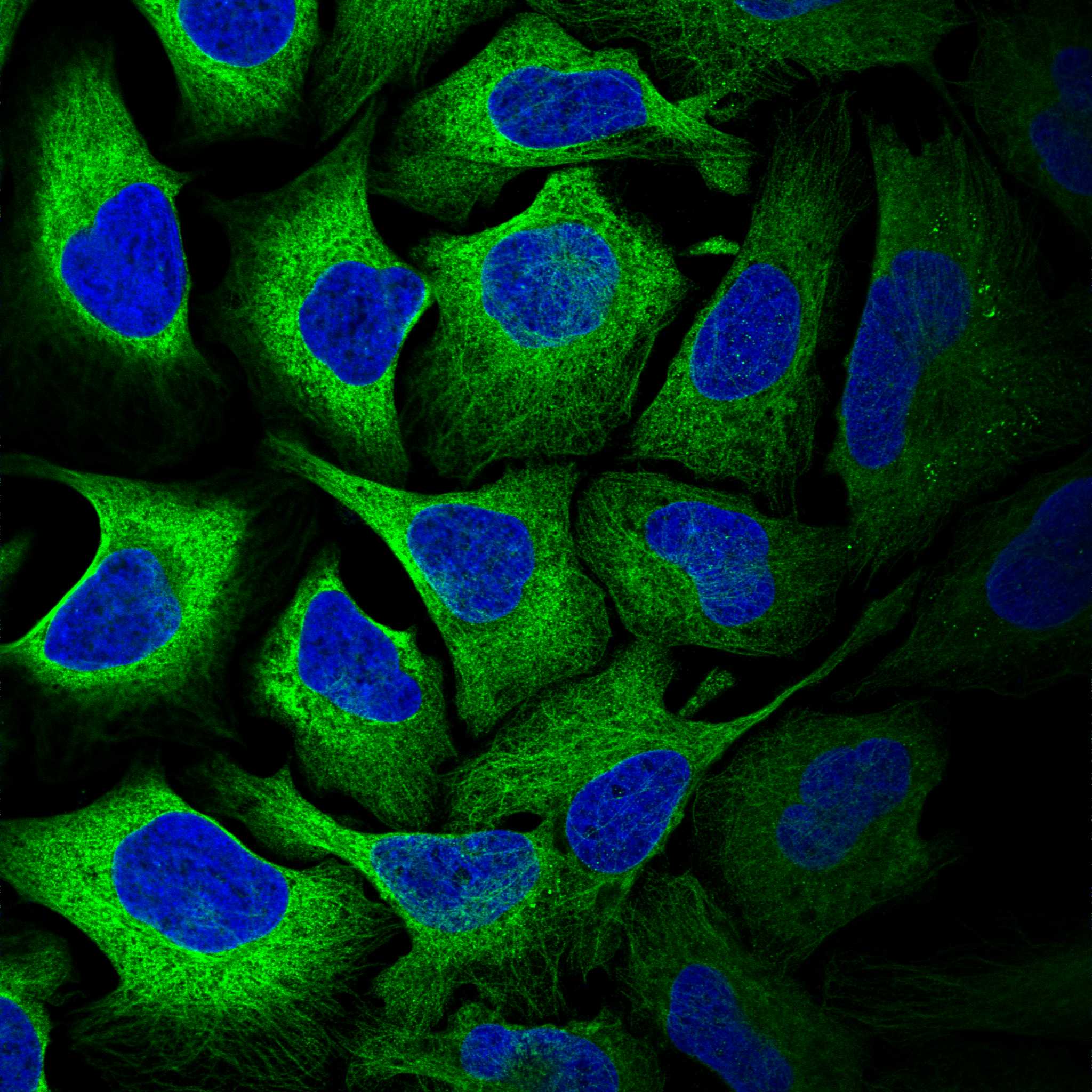 Subcellular GYS1 The Human Protein Atlas