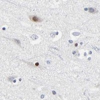 HPA IHC Cerebral cortex — SALL2