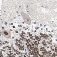 HPA IHC Cerebellum — SALL2