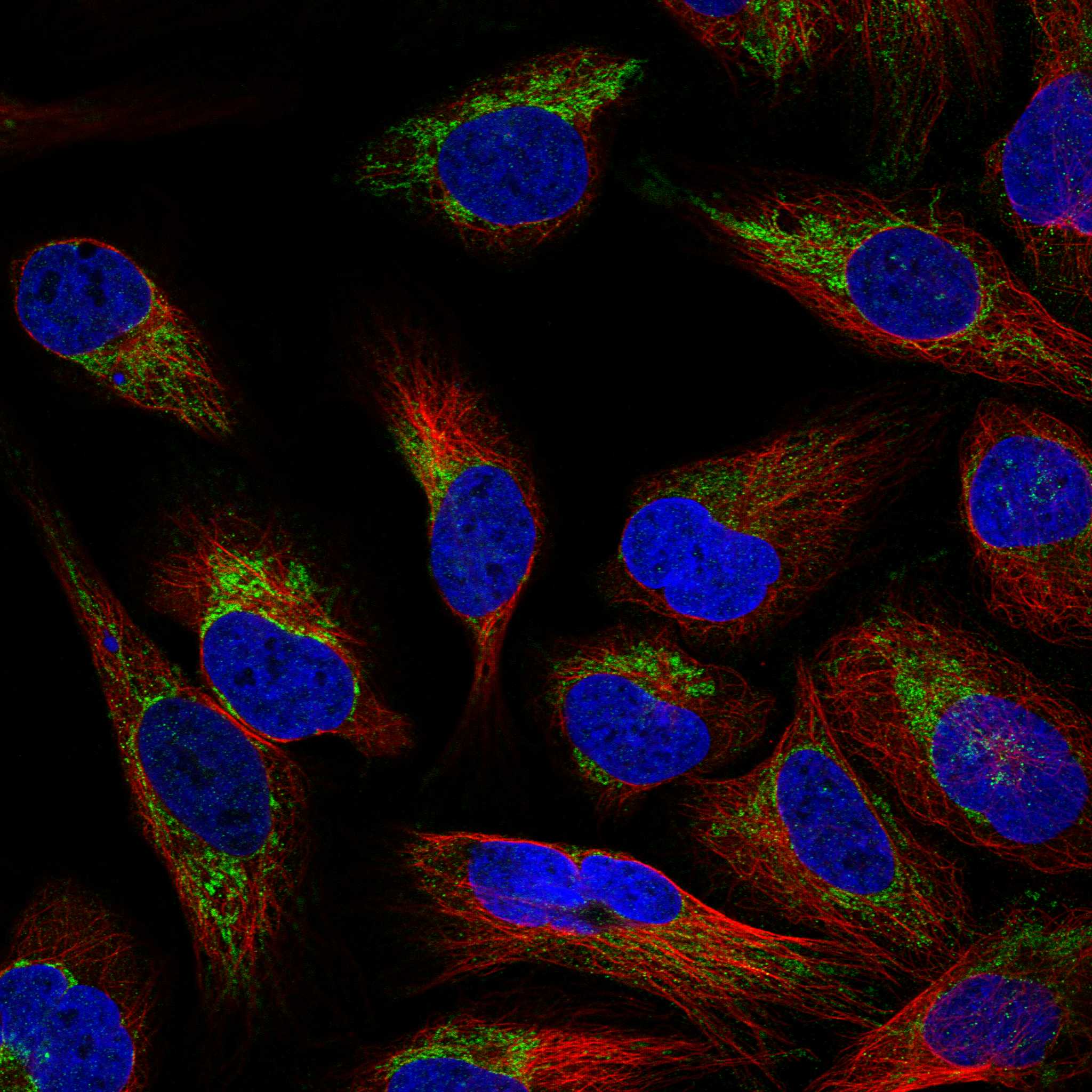 Subcellular FDX1 The Human Protein Atlas