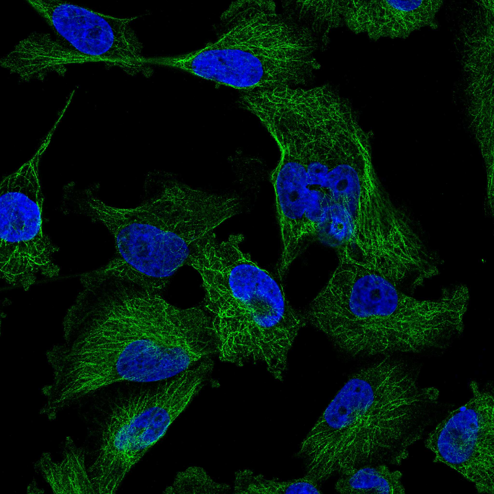 Subcellular SLC26A1 The Human Protein Atlas