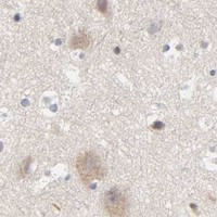 HPA IHC Cerebral cortex — RUNX1