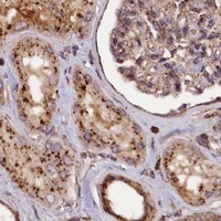 HPA IHC Kidney — IST1