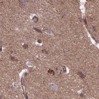 HPA IHC Cerebral cortex — IST1