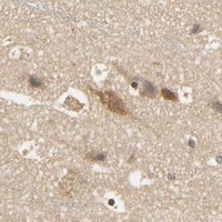 HPA IHC Cerebral cortex — PARK7