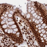 HPA IHC Colon — PRPF31