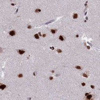 HPA IHC Cerebral cortex — PRPF31