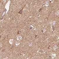 HPA IHC Cerebral cortex — SDHA